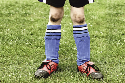 Fußball ist das einzige weit verbreitete Spiel, das den Einsatz der Hände verbietet. Die Füße müssen hier das leisten, was man sonst mit den Händen tut.