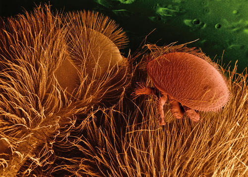 Huckepack: eine Varroa-Milbe auf einer Biene unter dem Mikroskop. Die Milben heften sich am Körper der ausgewachsenen Bienen an und saugen deren Hämolymphe, ihr Blut.