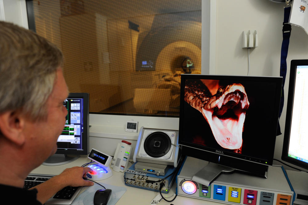 Gefühlsbilder: Während eines Versuchs sieht der Proband im MRT Fotos, die starke Emotionen auslösen, wie hier das Bild einer Schlange.